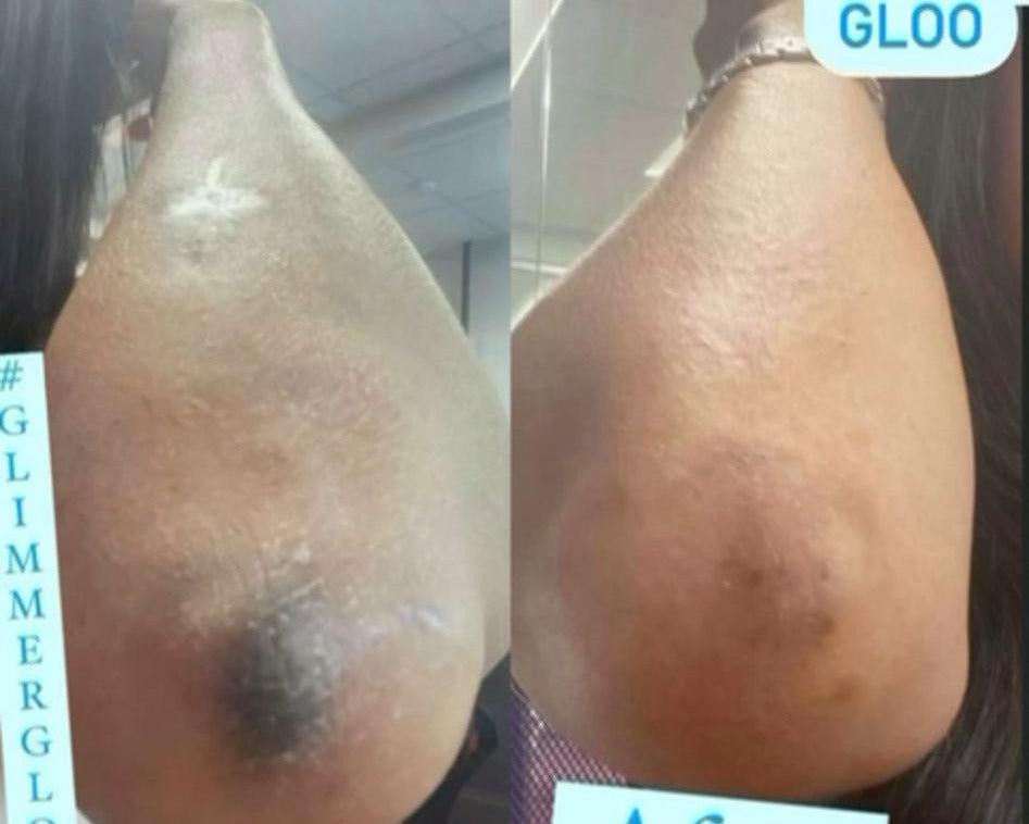 Extra Strong Knuckle Cream (SMALL)