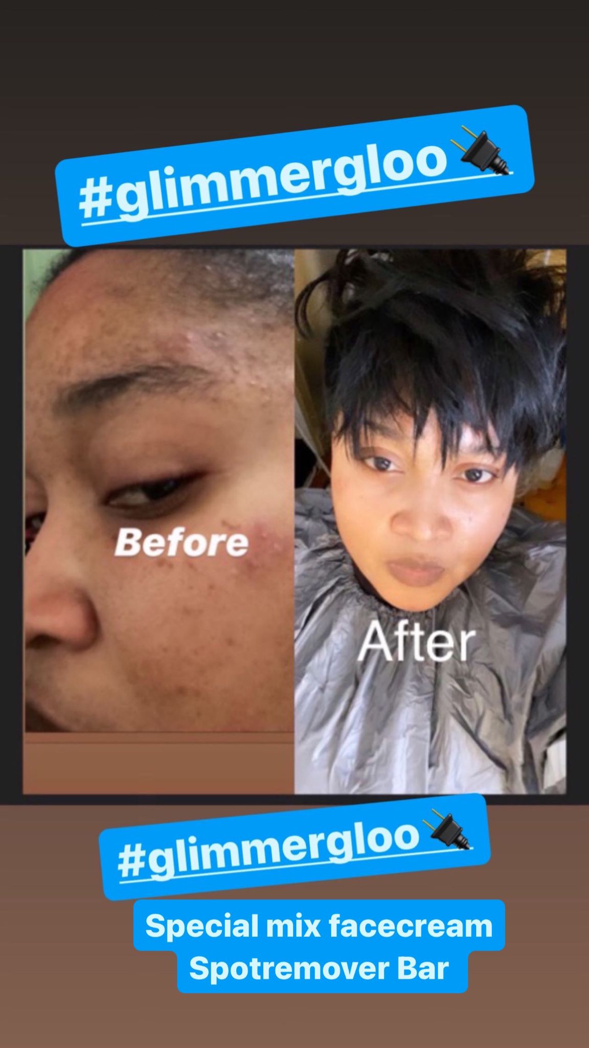 SPOTREMOVER BAR (TRAVEL SIZE)