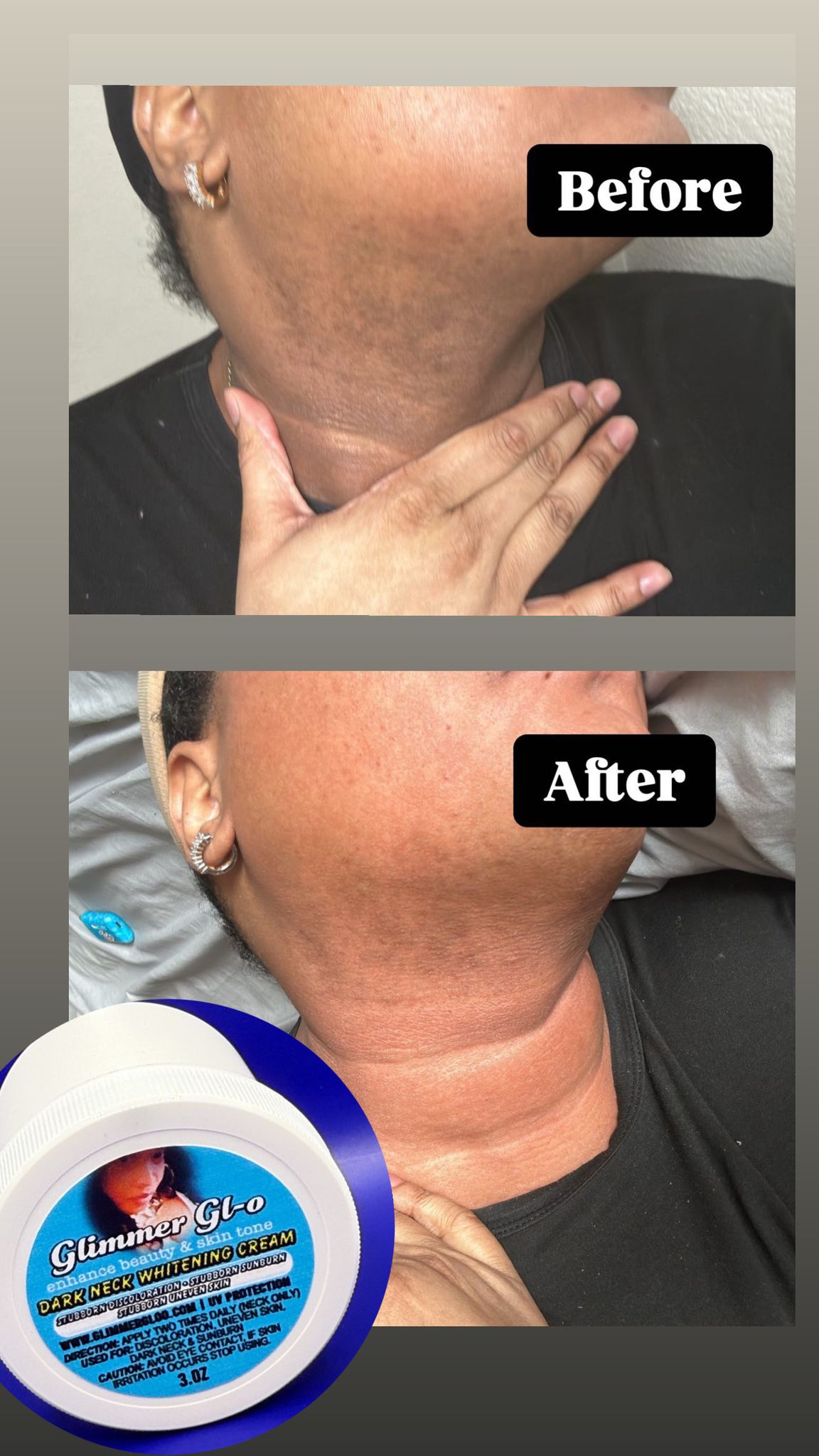 DARK NECK WHITENING CREAM