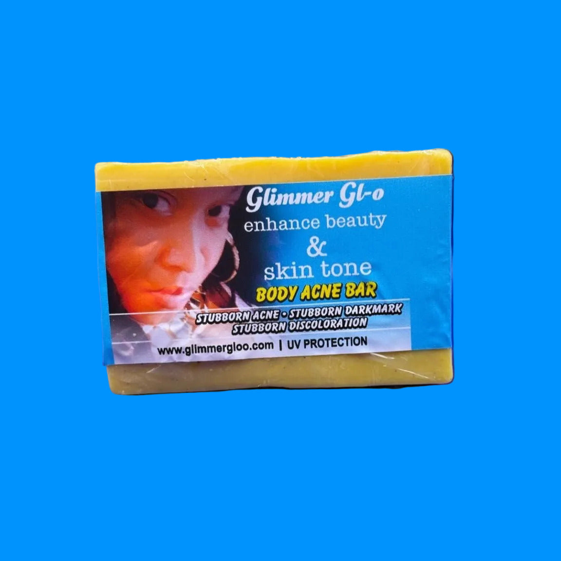 Body Acne Bar (Large)