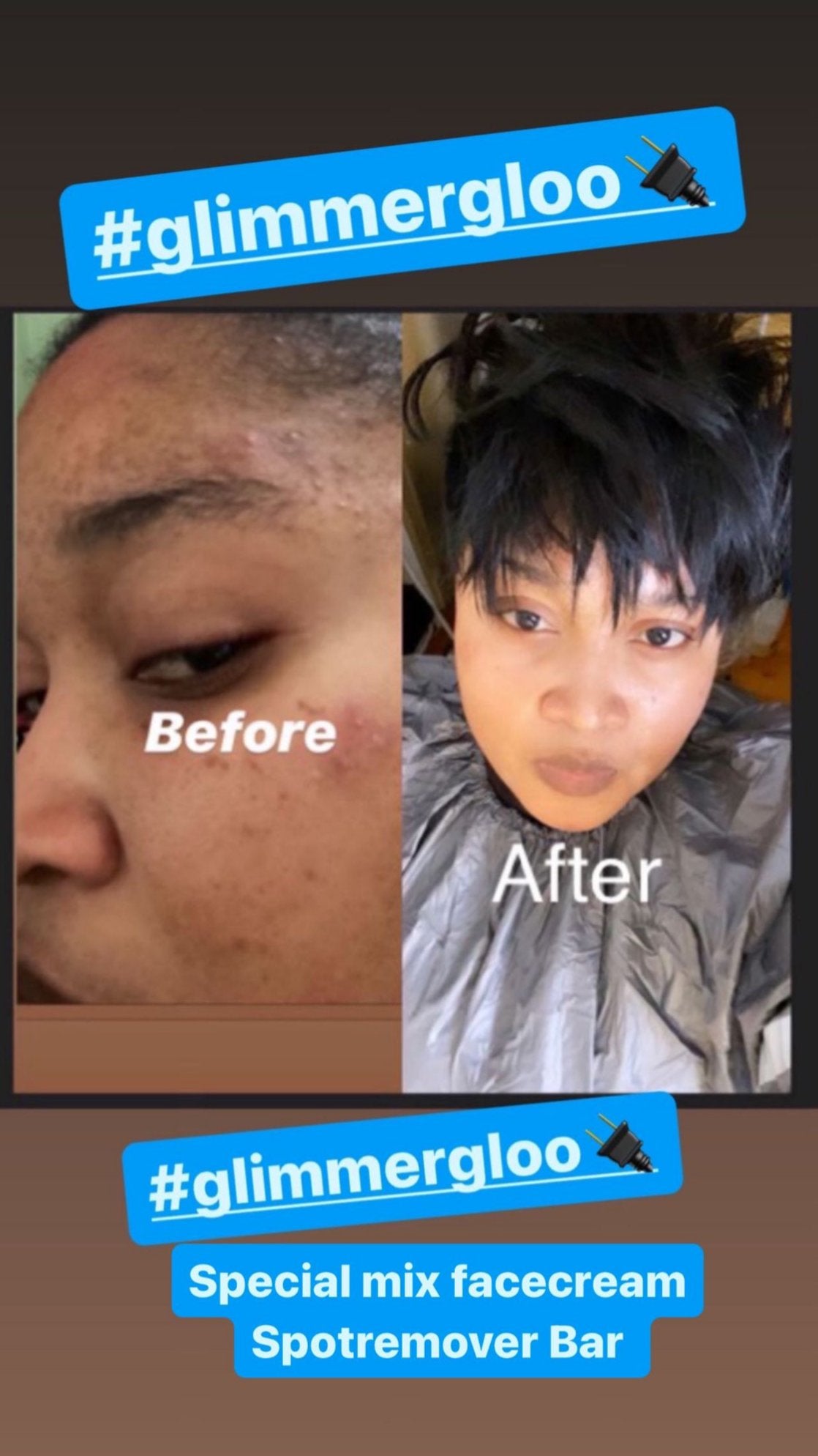 SPOT REMOVER BAR (LARGE) HIGH DEMAND