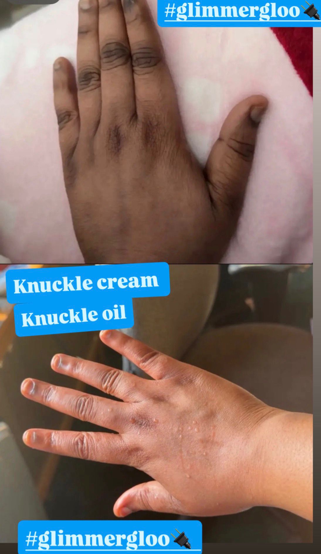 Knuckle Oil (SMALL)